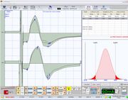 File:180px-TCS - Motor Evoked Potentials of trigeminal roots in open bite patient.jpg