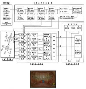 599px-Electrognathograph.jpg