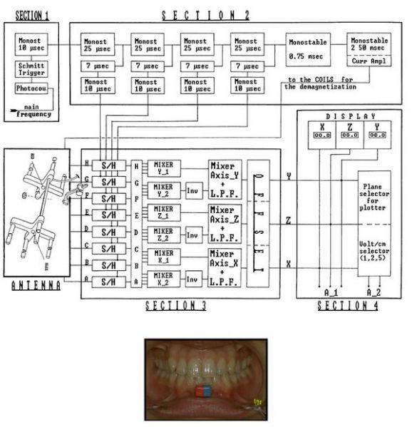 File:599px-Electrognathograph.jpg