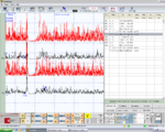 Figura 1: γ1= Periodo silente meccanico registrato sui muscoli masseteri destro ( in alto nero corrisponde alla media) sinistro ( in basso nero corrisponde alla media)