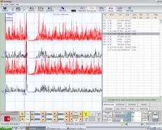 Figura 6: γ3 Periodo silente meccanico.