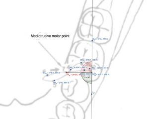 1131px-Figura Molare Mediotrusivo.jpg