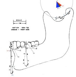 Sirignathograph rotazione asse Y.jpg