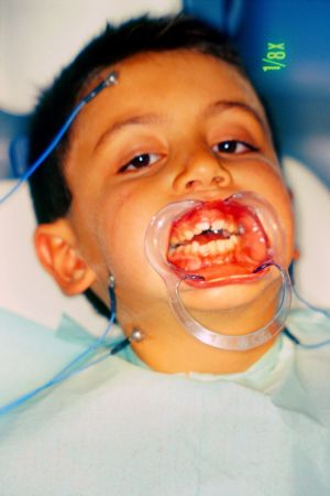 Epoc-0032 refined.jpg