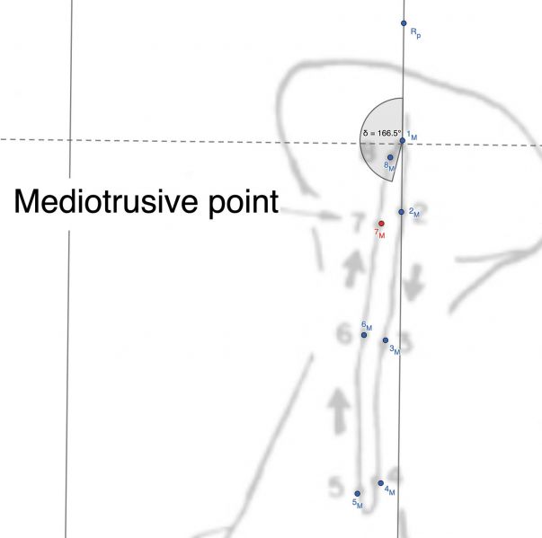 File:Mediotrusive angle.jpeg