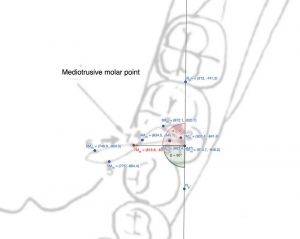 800px-Figura Molare Mediotrusivo.jpg