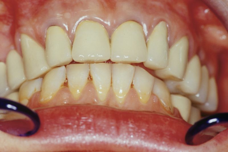 File:Pre Root-MEPs.jpeg
