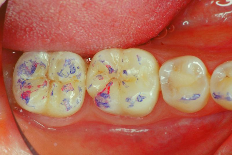 File:Clicker end4.jpg