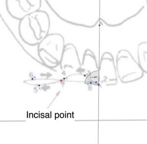 410px-Incisal angle.jpg