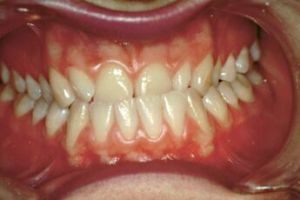 345px-Clicker 00.jpg