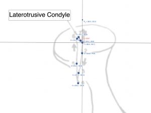 Figura Condilo laterotrusico.jpg