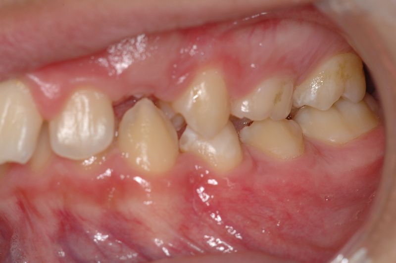 File:OrtoNeuroGnatodonzia 3.jpg