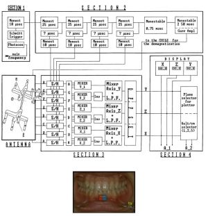 799px-Electrognathograph.jpg