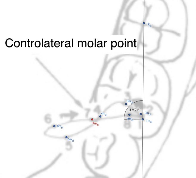 File:Controlateral molar point.jpeg