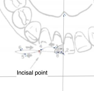Incisal angle.jpg