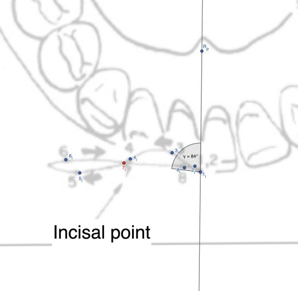 File:Incisal angle.jpg