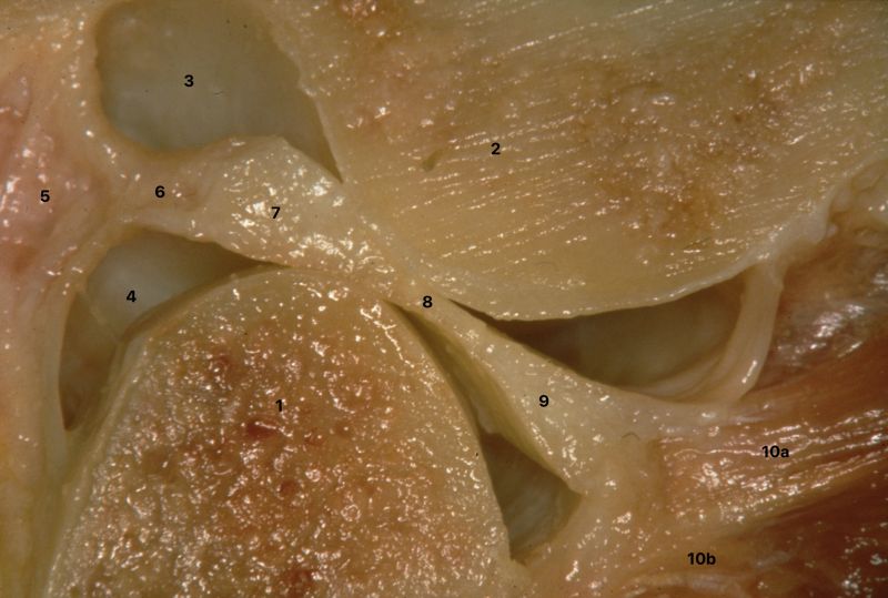 File:TMJ anatomy 1.jpg