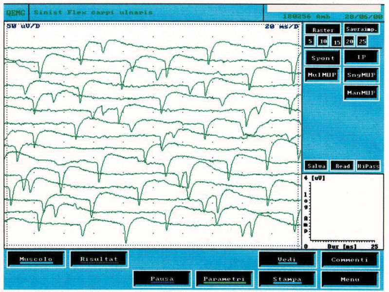File:EMG a punta+.jpeg