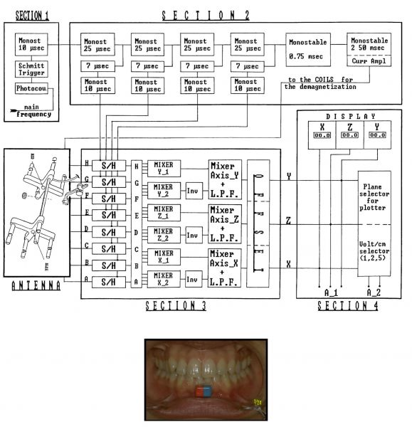 File:Electrognathograph.jpg
