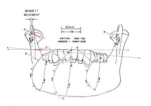 1180px-Sirognathograph frontal angle.jpg