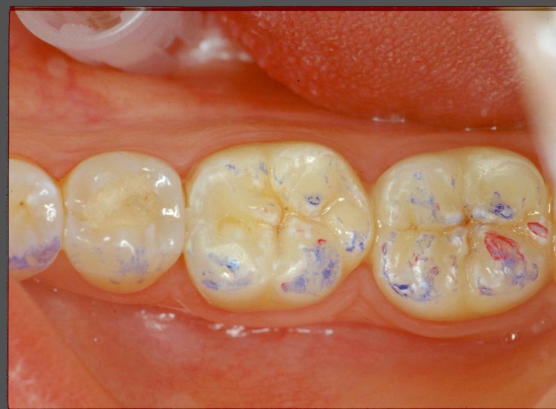 File:Clicker end3.jpg
