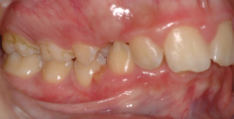 File:OrtoNeuroGnatodonzia 2.jpg