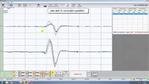 854px-seek=551-Scientific Phylosophy of the NGF method.mp4.jpg