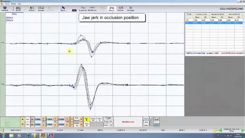 File:854px-seek=551-Scientific Phylosophy of the NGF method.mp4.jpg