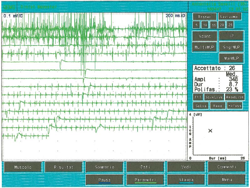 File:EMG Propofol.jpeg