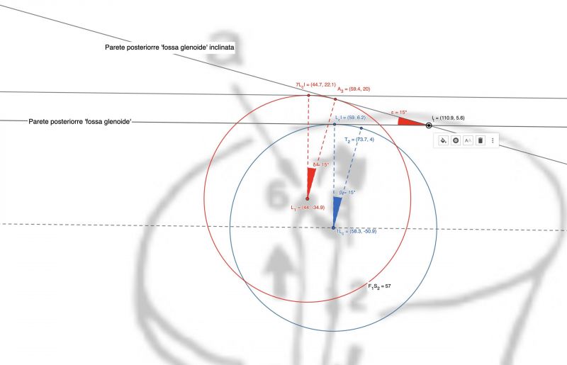 File:2560px-Figura 3 Condilo Laterotrusivo.jpg
