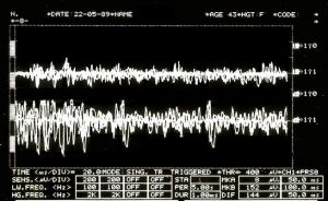 653px-EMG2.jpg