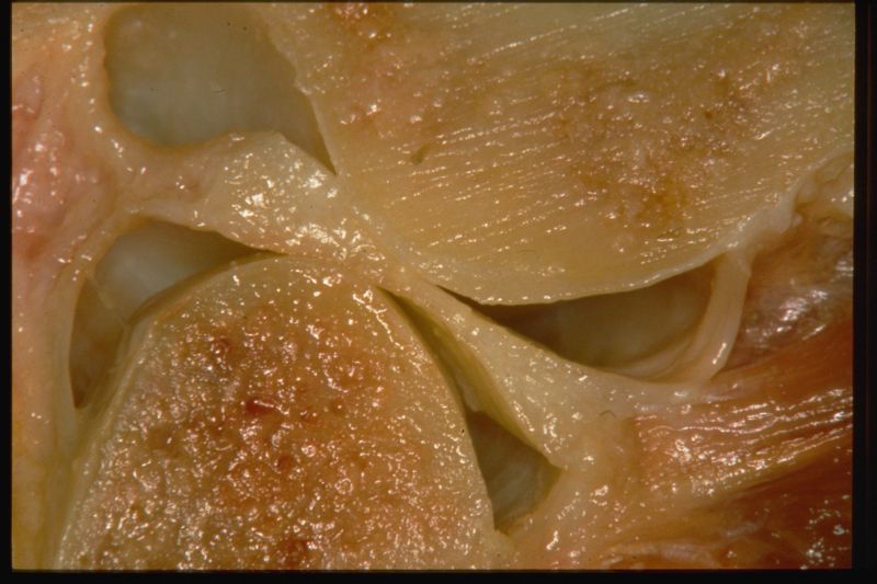File:TMJ anatomy.jpg