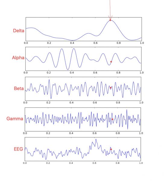 File:EEG.jpeg