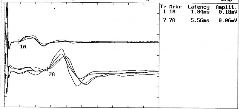 File:H-wave.jpg