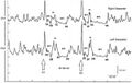 Figura 2: Ciclo di Recupero del Riflesso Inibitorio del Massetere (rcIMR) eseguito nell'anno 2014. Traccia successivamente considerata come operatore quantistico P^