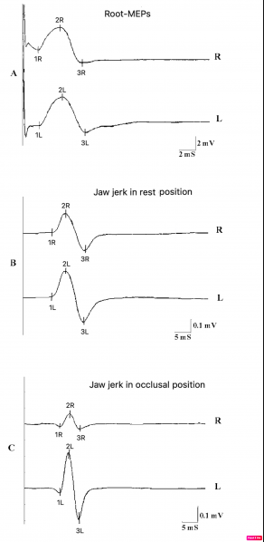 File:Clicker 01 copy.png