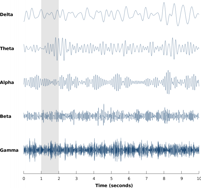 File:EEG Brainwaves.png