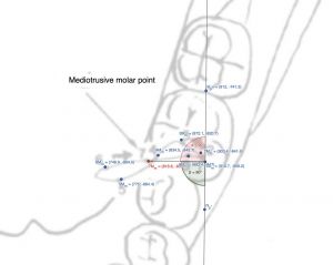 1508px-Figura Molare Mediotrusivo.jpg