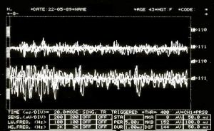 525px-EMG2.jpg
