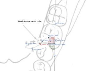 377px-Figura Molare Mediotrusivo.jpg