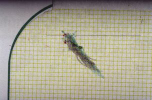 Figure 4: δ1= Axiography of the patient showing a flattening of the chewing pattern on the right condyle