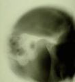 Miniatura della versione delle 17:21, 14 apr 2025