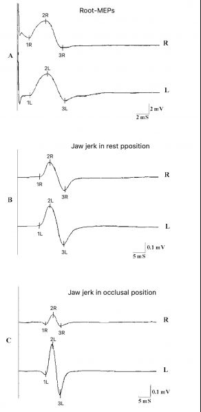 File:Clicker 01.jpg