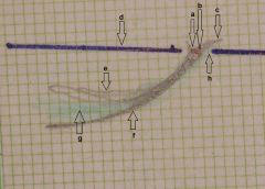 Figura 2: δ2 Tracciato assiografico paraocclusale consolare destro: a) Centro asse cerniera, b) piano asse orbitale, c) tracciato protruso, d) tracciato mediotrusivo, e) area dei cicli masticatori mediotrusivi, f) area cicli masticatori laterotrusivi, g) backline laterotrusiva.
